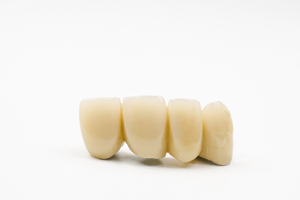 How To Make Your Dental Bridge Last