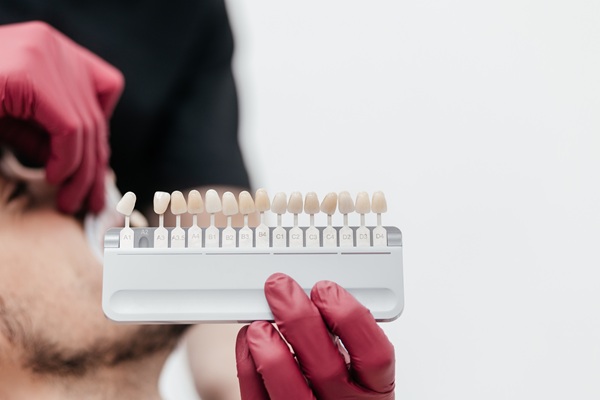 Are Dental Veneers Right For Me?