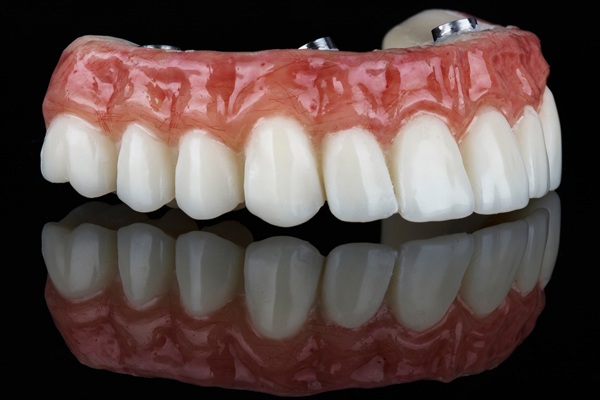 What Happens If I Need My Implant Supported Dentures Repaired?