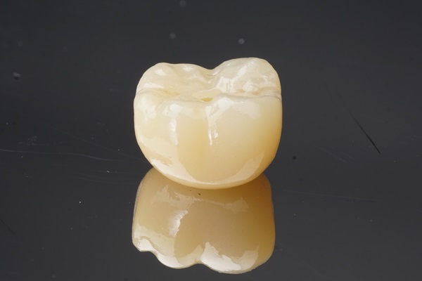 Same Day Dentistry: A New Smile Now  With Same Day Crowns